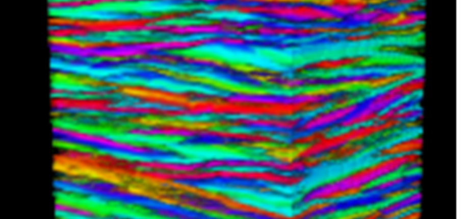 Mapping the structure of human corneas