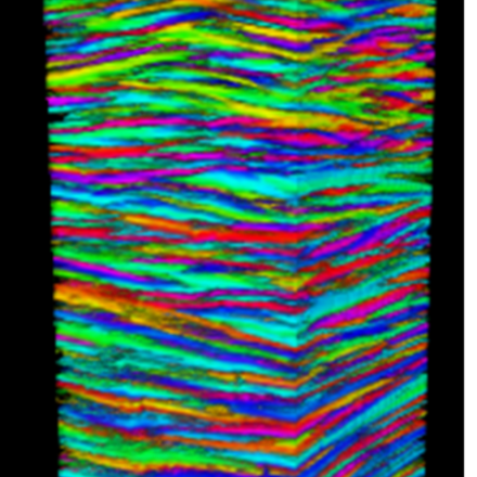 Mapping the structure of human corneas